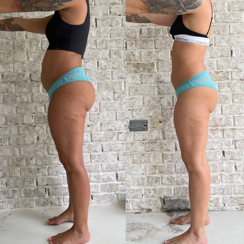 Before and after keto transformation